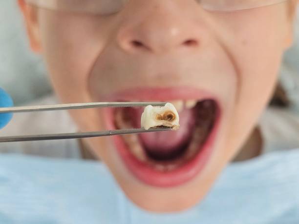 Best Teeth Whitening  in Vale, OR