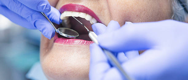 Teeth Whitening in OR